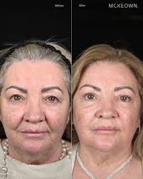 Dr Darren McKeown (@drdarrenmckeown) · Glasgow