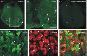 Pengen vc ama #binor kalao ada yg mau. Ontogenic Changes Of The Spinal Gabaergic Cell Population Are Controlled By The Serotonin 5 Ht System Implication Of 5 Ht1 Receptor Family Journal Of Neuroscience