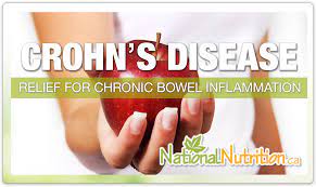 Crohn S Disease National Nutrition Articles