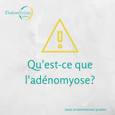 Ursachen der adenomyose symptome einer adenomyose arten der adenomyose grade der adenomyosis diagnose der adenomyose medikamentöse behandlung von adenomyosis. Facebook