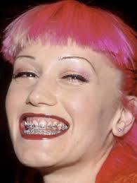 Gwen Stefani Was Known For Always Shocking The Country With Her Outfits Hair Make Up And Pretty Much Everything She Gwen Stefani Vintage Outfits Pink Braces