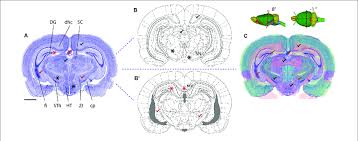 The rat genome database (rgd) is the. Mapping A Coronal Rat Brain Section With A Slight Tilt To A Reference Download Scientific Diagram
