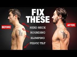 Poor posture can result in neck pain, shoulder knots/tension, and headache pain. How To Fix Your Posture In 4 Moves Permanently Youtube