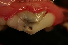 Important puppy teeth information for new owners. Broken Dog Tooth Treatment Veterinary Dentist Wisconsin Oshkosh Green Bay Greenfield Glendale Minnesota