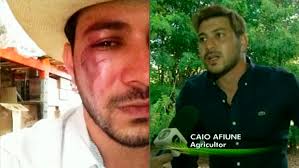Caio no bbb 21 imagem: Bbb 2021 Caio Aparece Com O Rosto Desfigurado Em Materia Da Globo Rd1