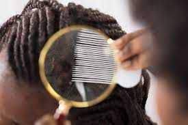 After looking at lice pictures or lice videos to know what they're looking for, have the person carefully lift sections of your hair and look along it near the scalp. Tips To Be Fit How To Deal With Head Lice Health Phillytrib Com