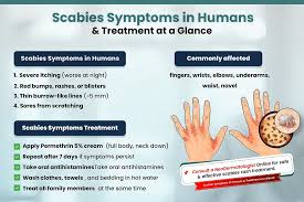 Image result for scabies human symptoms