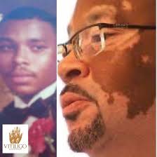 Question from one of our followers, Bill: What is some sun block that  others have had luck with?