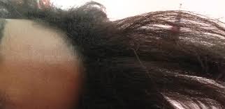 The warm water will help open the cuticles of the hair so that the shampoo can penetrate deeper and remove dirt and oil from the hair. Recently Ive Stopped Using Relaxer After Using It For 5 Years My Roots Are At Its Natural Thick Krinkly Tangly State And I Have No Clue What To Do With It
