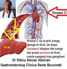 Uneori, la începutul infecţiei putem fi galbeni, obosiţi sau putem avea greaţă și dureri, iar oboseala poate dura. Hepatita C Se Vindeca Cabinet De Gastroenterologie Si Hepatologie Bucuresti 0758 751 841