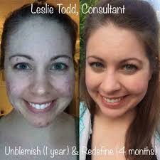 How would your life change if you finally felt confident in your own skin?