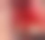 Image result for granuloma gum disease