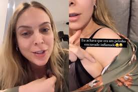 Tata Estaniecki descobre terceiro mamilo após gravidez: Sai leite