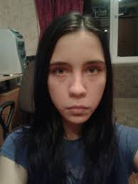 Otvety Mail Ru Nos Kartoshkoj Chto Delat Dlya Menya Eto Problema Foto