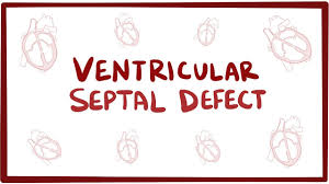 ventricular septal defect vsd an osmosis preview