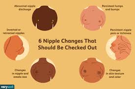 They can help you decide when to do it, but most people should get a colonoscopy to look for polyps at 50. Nipple And Areolar Changes What S Normal What S Not