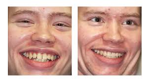 Oak Park Dentist Patient Testimonials-Dr. James Scapillato