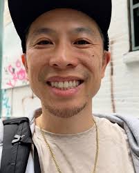 😬 Before & After @invisilign 😄, Finally after one whole year I am done!  Oops meant to put May 2025 but u get it