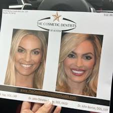 THE COSMETIC DENTISTS OF AUSTIN