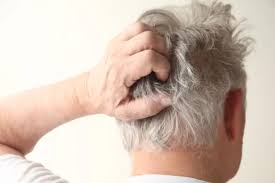 It can appear in single or several patches. Do S And Don Ts For Scalp Psoriasis
