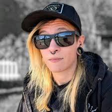 3dprinting #prosthetics #orthotics