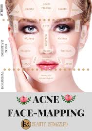 acne face mapping what does your acne tell you face