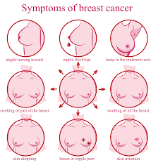 Dimpling of the breast tissue can be a sign of a serious form of cancer known as inflammatory breast cancer. Breast Cancer Symptoms And Signs Audacious You
