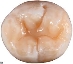 Image result for Occlusal