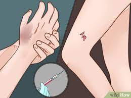 How To Know When You Need A Tetanus Shot 11 Steps With Pictures
