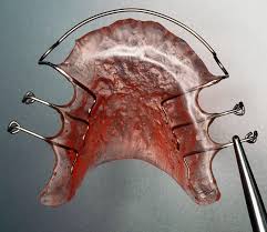 The system can be used after any type of orthodontic treatment method, invisalign® or not. Hawley Retainer Cost Care Benefits Colors