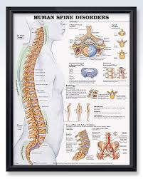 human spine disorders chart 20x26 human anatomy chart