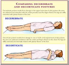 Control Of Posture Postural Reflexes Medatrio