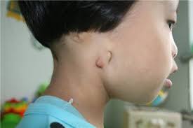 FYI for Lunas friends. Most of you know she is deaf, she is loosing her eye  sight... we are keeping her in and she really doesn't even try to get out  because