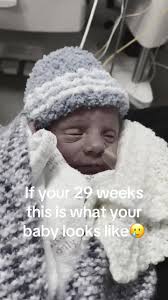 My 29 weeker boy!! Hes one strong fighter❤️#29weekspremature