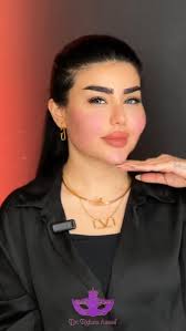 معالجة الحبوب بالليزر ونتائج افضل بعد معالجة الآثار 👌🏻