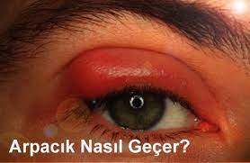 Arpacik Nasil Gecer Panosundaki Pin