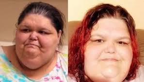 MY 600 LB LIFE Robin and Garrett, at a combined 1200+ pounds, are in a race  against time