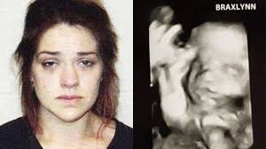 Bayi Belum Lahir Dikeluarkan Paksa, Wanita Bunuh Teman yang Hamil Tua,  Pelakunya Berakting di RS