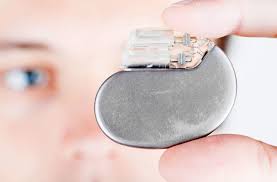 Create and share mixtapes with millions of tracks! Pacemakers And Defibrillators Save Lives In Different Ways Health Essentials From Cleveland Clinic
