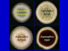 Aspergillus niger is the most common species of aspergillus. 58 Aspergillus Ideas Fungi Microbiology Medical Laboratory