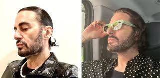 Marc Jacobs Facelift