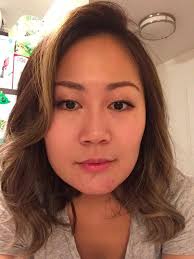 Who provides Botox treatment for teeth grinding in Greenville, SC?