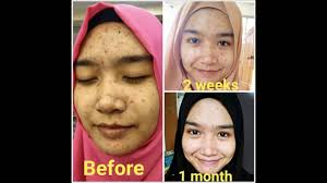 Pemilik situs web ini tidak menjamin hasil pemakaian dan tidak memberikan garansi hasil dari pemakaian. Dermags Intensive Brightening Serum Youtube