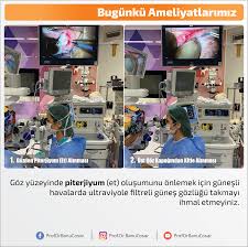 Goz Yuzeyinde Piterjiyum Et Olusumunu Onlemek Icin Gunesli Havalarda Ultraviyole Filtreli Gunes Gozlugu Takmayi Ihmal Etmeyiniz Gunes Gozlugu Bilgi Gozler
