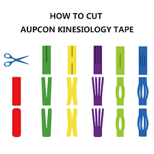 Pin On Kinesio Taping Knee