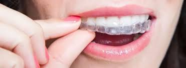 Are Adult Orthodontics Really Worth It?