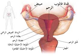 مرض التهاب الحوض ويكيبيديا