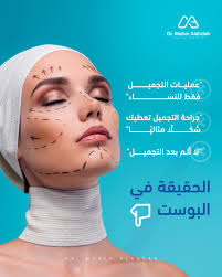 في عالم جراحة التجميل، المعلومات المغلوطة تنتشر بسرعة أكبر من الحقائق! 🧐  🚨 الحقيقة: 🔹 عمليات التجميل ليست حكرًا على النساء، فهناك رجال يجرونها  لأسباب تجميلية وعلاجية. 🔹 لا يمكن لأي عملية