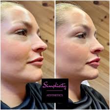 Simplicity Aesthetics and Skin Care