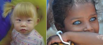 So, it's recommended for blondes with blue eyes to protect their eyes with sunglasses when they're. Pin On The Beauty Of God